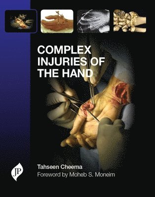 bokomslag Complex Injuries of the Hand