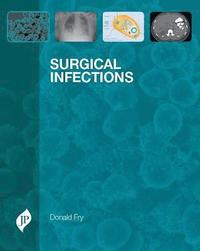 bokomslag Surgical Infections