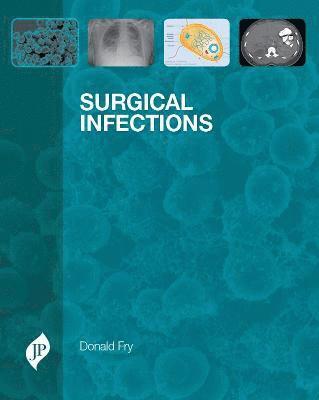 bokomslag Surgical Infections