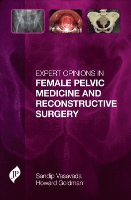 Expert Opinions in Female Pelvic Medicine and Reconstructive Surgery 1