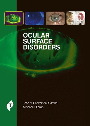 bokomslag Ocular Surface Disorders