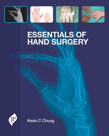 Kevin C Chung - Essentials of Hand Surgery, Inbunden