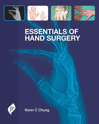 bokomslag Essentials of Hand Surgery