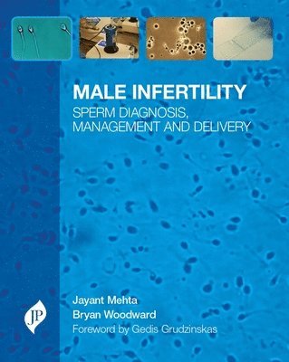 bokomslag Male Infertility