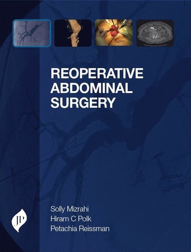 bokomslag Reoperative Abdominal Surgery