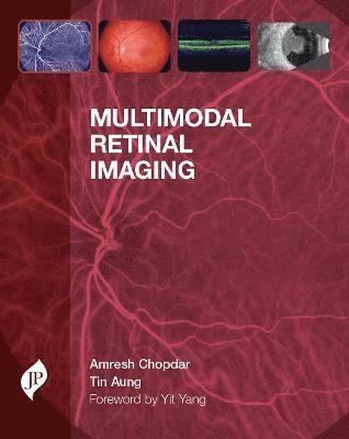 bokomslag Multimodal Retinal Imaging