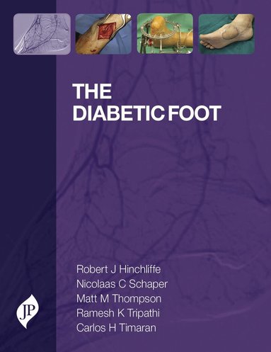 Robert Hinchliffe, Matt Thompson, Nicolaas Schaper, Ramesh Tripathi, Carlos Timaran - Diabetic Foot, Inbunden