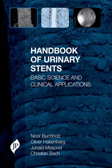 Noor Buchholz, Oliver Hakenberg, Junaid Masood, Christian Bach - Handbook of Urinary Stents, Inbunden