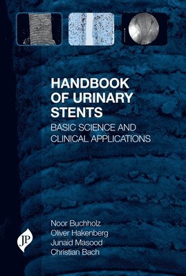 bokomslag Handbook of Urinary Stents
