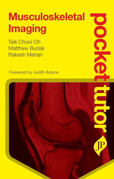 Teik Chooi Oh, Matthew Budak, Rakesh Mehan - Pocket Tutor Musculoskeletal Imaging, Häftad