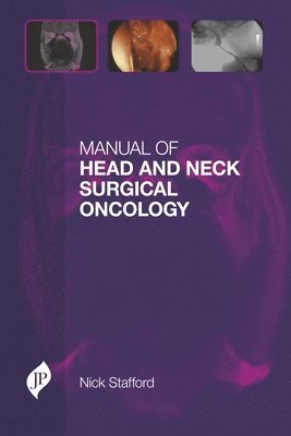 Manual of Head and Neck Surgical Oncology 1