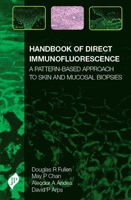 Handbook of Direct Immunofluorescence 1