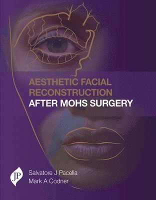 bokomslag Aesthetic Facial Reconstruction After Mohs Surgery