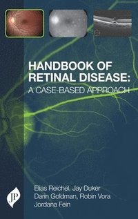 bokomslag Handbook of Retinal Disease: a Case-based Approach