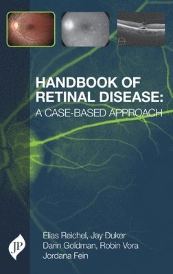 bokomslag Handbook of Retinal Disease: a Case-based Approach