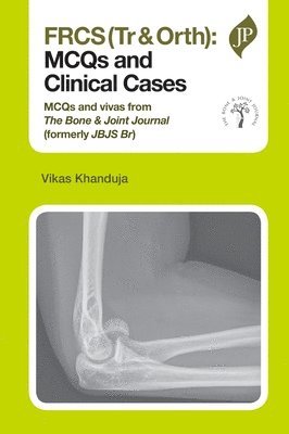 FRCS(Tr & Orth): MCQs and Clinical Cases 1