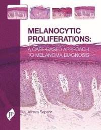 bokomslag Melanocytic Proliferations