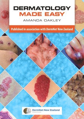 bokomslag Dermatology Made Easy