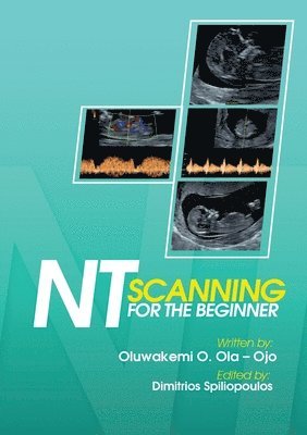 NT Scanning for the Beginner 1