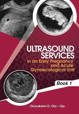 bokomslag Ultrasound Services in An Early Pregnancy and Acute Gynaecological Unit