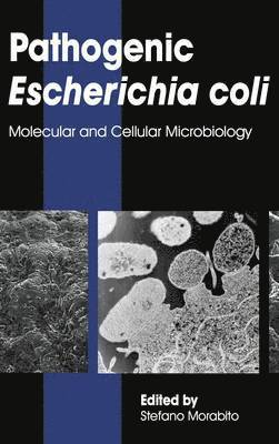 Pathogenic Escherichia Coli 1