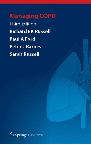 Richard EK Russell, Paul A Ford, Peter J. Barnes, Sarah Russell - Managing COPD, Häftad