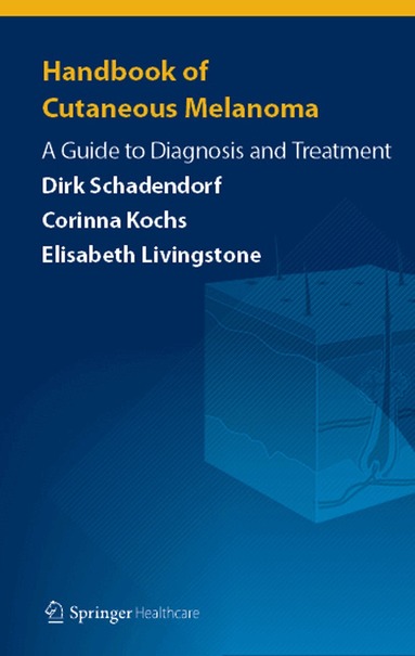 Dirk Schadendorf, Corinna Kochs, Elisabeth Livingstone - Handbook of Cutaneous Melanoma, Häftad