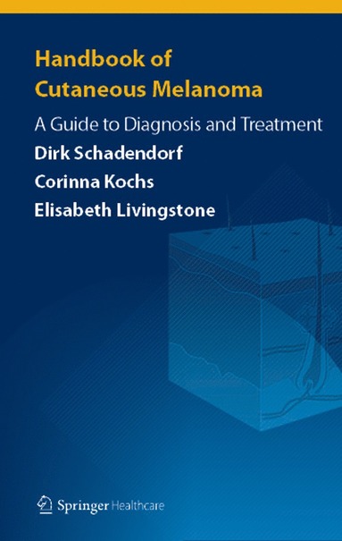 bokomslag Handbook of Cutaneous Melanoma