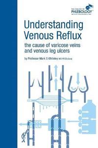 bokomslag Understanding Venous Reflux the Cause of Varicose Veins and Venous Leg Ulcers