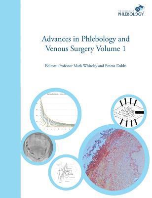 Advances in Phlebology and Venous Surgery: Volume 1 1