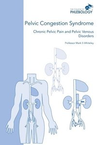 bokomslag Pelvic Congestion Syndrome - Chronic Pelvic Pain and Pelvic Venous Disorders