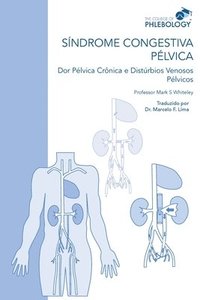 bokomslag SÍNDROME CONGESTIVA PÉLVICA Dor Pélvica Crônica e Distúrbios Venosos Pélvicos