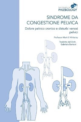 bokomslag Sindrome da congestione pelvica - Dolore pelvico cronico e disturbi venosi pelvici