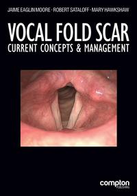 bokomslag Vocal Fold Scar