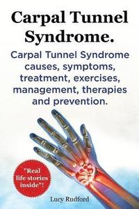 bokomslag Carpal Tunnel Syndrome, Cts. Carpal Tunnel Syndrome Cts Causes, Symptoms, Treatment, Exercises, Management, Therapies and Prevention.