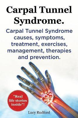 Carpal Tunnel Syndrome, Cts. Carpal Tunnel Syndrome Cts Causes, Symptoms, Treatment, Exercises, Management, Therapies and Prevention. 1