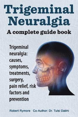 bokomslag Trigeminal Neuralgia