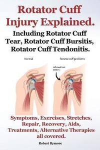 bokomslag Rotator Cuff Injury Explained. Including Rotator Cuff Tear, Rotator Cuff Bursitis, Rotator Cuff Tendonitis. Symptoms, Exercises, Stretches, Repair, Recovery, Aids, Treatments, Alternative Therapies