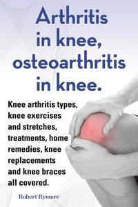 bokomslag Arthritis in knee, osteoarthritis in knee. Knee arthritis types, knee exercises and stretches, treatments, home remedies, knee replacements and knee braces all covered.