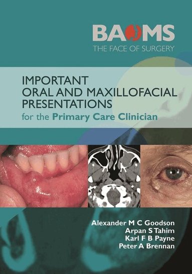 Alexander M. C. Goodson, Karl F. B. Payne, Peter A. Brennan, Arpan Tahim - Important Oral and Maxillofacial Presentations for the Primary Care Clinician, Häftad