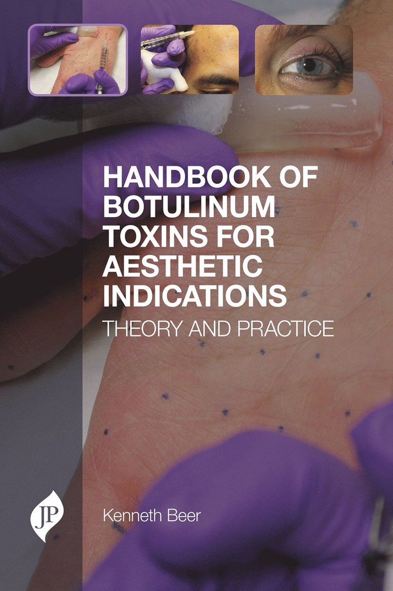 Kenneth Beer - Handbook of Botulinum Toxins for Aesthetic Indications, Inbunden