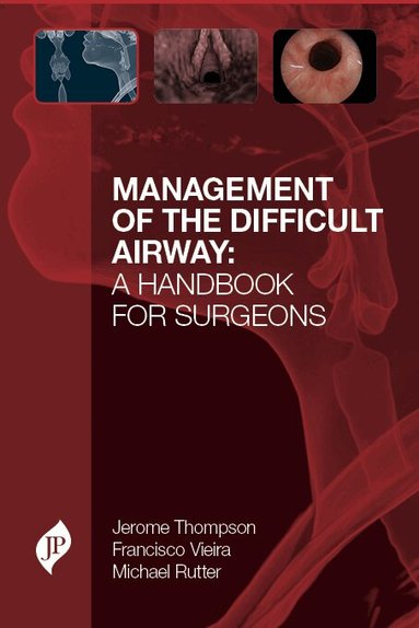 Jerome W Thompson, Francisco O M Vieira, Michael J Rutter - Management of the Difficult Airway: A Handbook for Surgeons, Inbunden