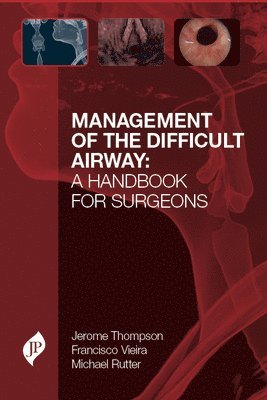 Management of the Difficult Airway: A Handbook for Surgeons 1