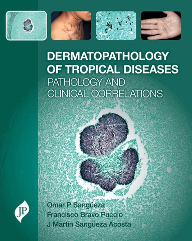 Omar P Sangüeza, Martin Sangüeza, Francisco Bravo - Dermatopathology of Tropical Diseases, Inbunden