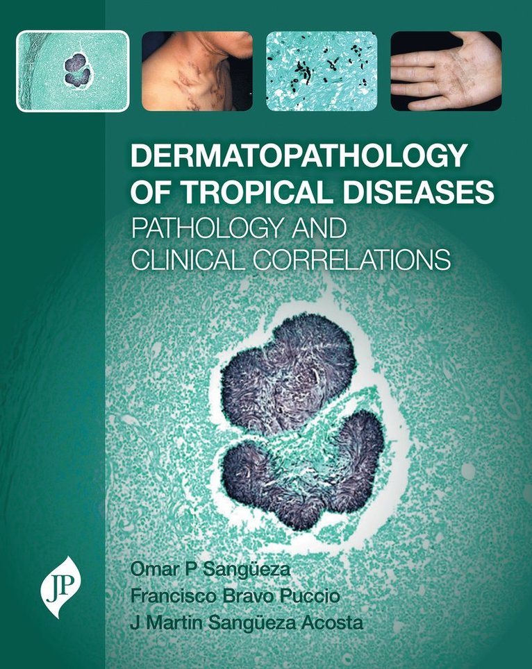 Omar P Sangüeza, Martin Sangüeza, Francisco Bravo, Omar P Sangueza, Martin Sangueza - Dermatopathology of Tropical Diseases, Inbunden