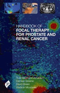 bokomslag Handbook of Focal Therapy for Prostate and Renal Cancer