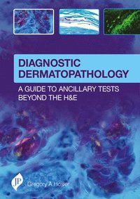 bokomslag Diagnostic Dermatopathology: A Guide to Ancillary Tests Beyond the H&E