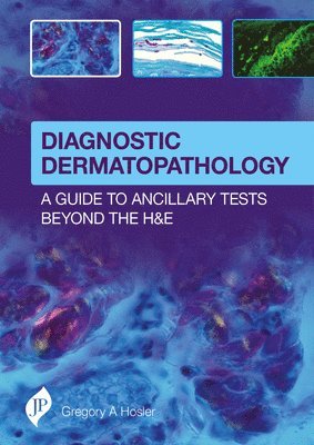 Gregory A Hosler - Diagnostic Dermatopathology: A Guide to Ancillary Tests Beyond the H&E, Inbunden
