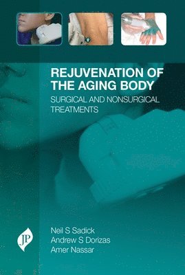 bokomslag Rejuvenation of the Aging Body