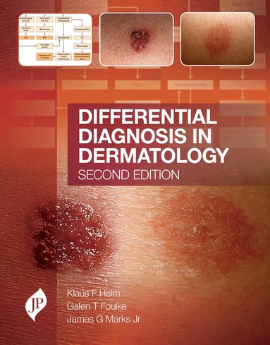 Klaus F. Helm, James G. Marks, Galen T. Foulke - Differential Diagnosis in Dermatology, Inbunden